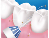 Bezprzewodowy irygator ORAL-B Aquacare 4 – zdjęcie 2