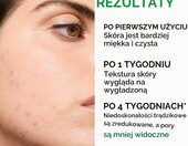 Vichy Normaderm 50 ml – krem nawilżający przeciw niedoskonałościom – zdjęcie 4