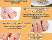 Joycabin zestaw 104 elementów do korekcji wrastających paznokci – zdjęcie 4