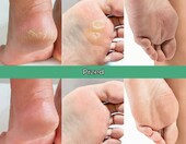PLANTIFIQUE skarpetki złuszczające do stóp, 2 pary – peeling z witaminami – zdjęcie 3