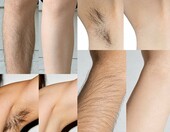 MLVONA pianka do depilacji w sprayu 140 ml – z olejem kokosowym – zdjęcie 3