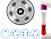 QWORK Wirowka laboratoryjna stolowa 6x20 ml, 4000 obr./min – zdjęcie 4