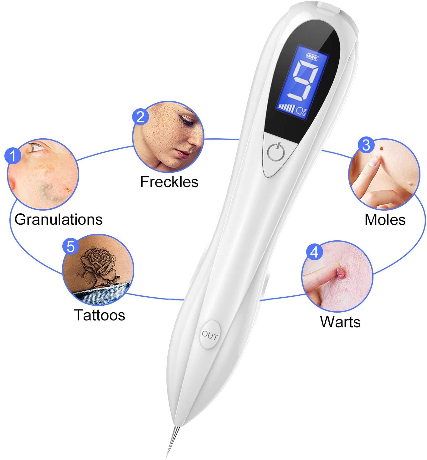 Długopis do usuwania brodawek ALDOM MOLE Removal Pen laser